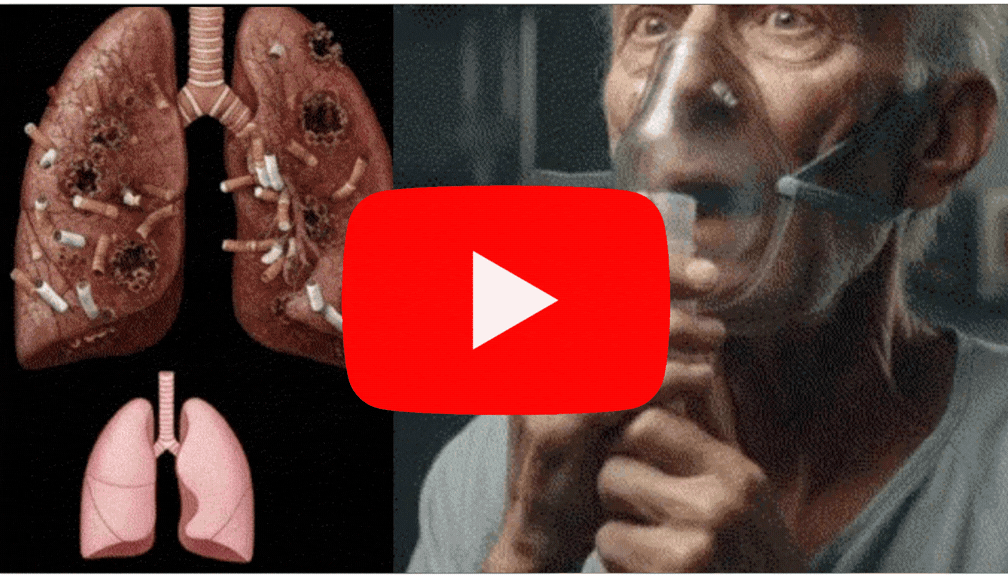 Iconic Artist & Dr. Barbara O. — COPD Lung Valve Mechanism Free Interview